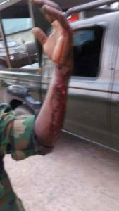 the injured Corporal Kolawole Matthey Bello
