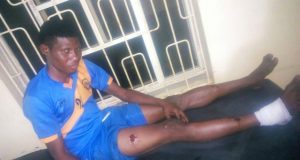 Football League Players Attacked, Butchered By Robbers On Benin Expressway, Check Pictures Osun United FC