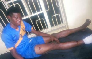 Football League Players Attacked, Butchered By Robbers On Benin Expressway, Check Pictures Osun United FC