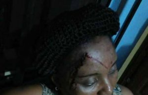 Shootings In Nnamdi Kanu’s Residence: Army, IPOB Trade Words ...the unnamed lady passerby 'attacked'...(Facebook photo)
