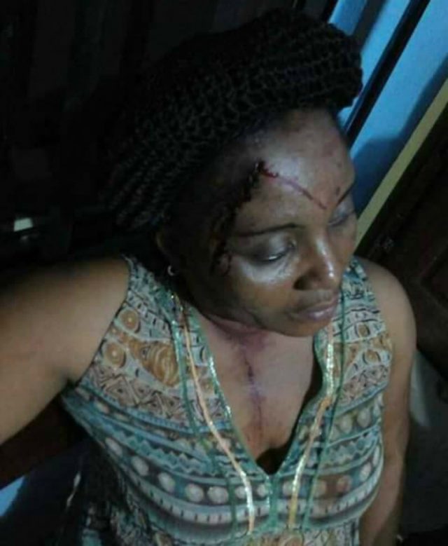...the unnamed lady passerby 'attacked'...(Facebook photo)