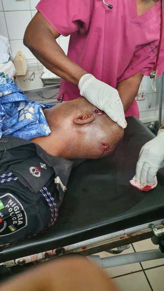 DCP Umar Bele after he was shot...on Monday...