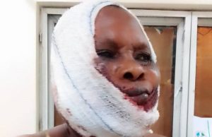 How Woman’s Jaw Was Broken By Suspected Fulani Herdsmen In Ogun Morenikeji Salami...attacked and almost killed...