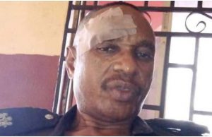 How DPO Was Attacked By School Students In Ogun SP Alimeke Ignatius...after the attack...