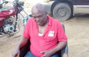 Primary Election: How Violence Erupted At APC’s Ekiti Central Constituency ...victim of violence during Ekiti APC primary election...