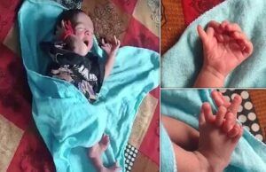 Read About Baby Born In India With 14 Fingers, 12 Toes ...the baby from India with 12 toes...