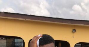 Colleagues Want Justice For Journalist Allegedly Brutalized By DSS Officers In Ibadan Mr. Tony Babatunde Daniel...after the alleged encounter with the DSS officers...