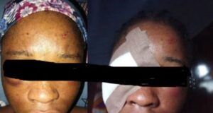 How Jealous Ex-Boyfriend Brutally Assaulted Undergraduate