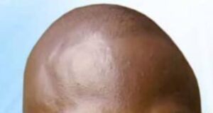 Adeniji, Federal Medical Center Worker Kills Self In Ogun ...the deceased...Oluwaseyi Adeniji...