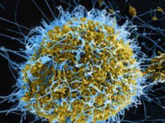 Doctors To Govts: Prepare Nigerians For Possible Ebola Outbreak