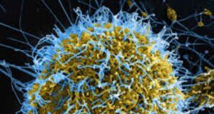 Doctors To Govts: Prepare Nigerians For Possible Ebola Outbreak