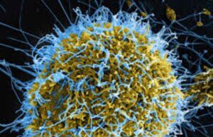 Doctors To Govts: Prepare Nigerians For Possible Ebola Outbreak