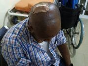 How AEDC Officials Were Injured During Anti-Power Theft Operation At Dawaki Police Quarters