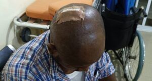 How AEDC Officials Were Injured During Anti-Power Theft Operation At Dawaki Police Quarters