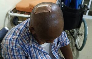 How AEDC Officials Were Injured During Anti-Power Theft Operation At Dawaki Police Quarters