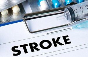 Stroke Hits One Nigerian Every Minute, Neurologists Raise The Alarm