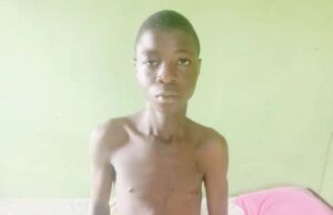 Hernia Surgery: Family Seeks ₦300,000 For 16-Year-Old ...the inguinal hernia patient...