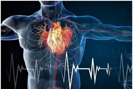 Experts Reveal How High Cholesterol Can Trigger Heart Attack ...cholesterol flow in diagram...